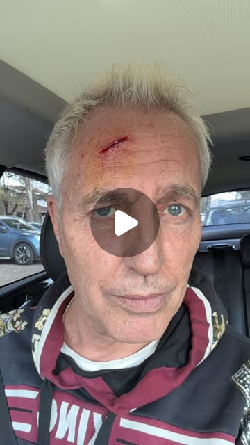 Vista previa de Marley contó en un video cómo se golpeó la frente en una panadería